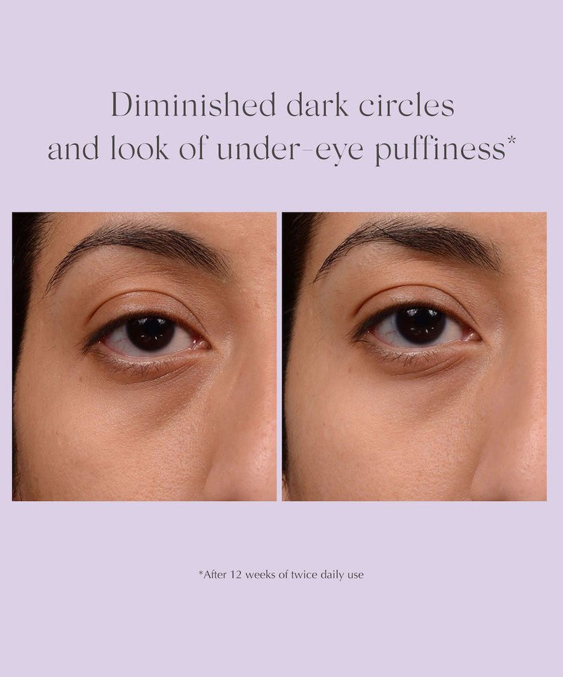 Crema contur ochi cu efect iluminator - Bright Eyes Dark Circle Corrector - 15g